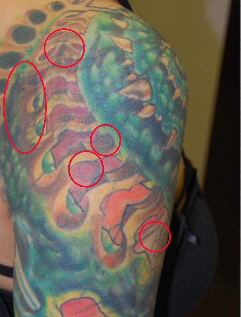 TattooÜberdeckungeinesvorher3xüberdecktenCoverUpTattoo